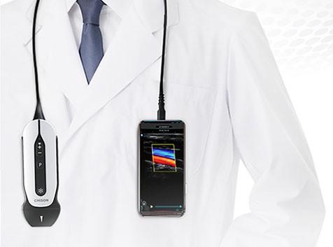 SonoEye Handheld Ultrasound